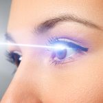 laserowa korekcja wzroku