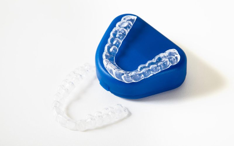 Czy po Invisalign trzeba nosić retainery i jak długo?